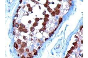 Image no. 2 for anti-T-Complex 1 (TCP1) (C-Term) antibody (ABIN374406)