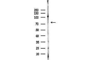Western blot analysis of lysates from Mouse testis, using hnRNP M Antibody at 1/1000 dilution.