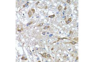 Immunohistochemistry of paraffin-embedded rat brain using OSGEPL1 antibody. (OSGEPL1 antibody  (AA 1-270))