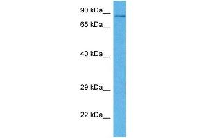 Host:  Rabbit  Target Name:  CPEB4  Sample Tissue:  Human DLD1 Whole Cell  Antibody Dilution:  1ug/ml (CPEB4 antibody  (N-Term))