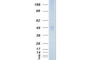 ILK Protein (Transcript Variant 2) (Myc-DYKDDDDK Tag)