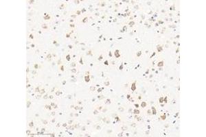 Immunohistochemistry analysis of paraffin-embedded mouse brain using,KCNF1 (ABIN7075155) at dilution of 1: 2400