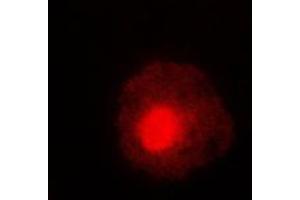 Immunofluorescent analysis of ABL1/2 (pY393/439) staining in HeLa cells. (ABL1/2 antibody  (C-Term, pTyr393, pTyr439))