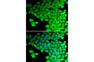 Immunofluorescence analysis of HeLa cells using MYL2 antibody. (MYL2 antibody  (AA 1-166))