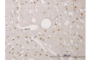 Immunoperoxidase of monoclonal antibody to TP53RK on formalin-fixed paraffin-embedded human cerebral cortex. (TP53RK antibody  (AA 154-253))