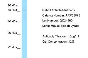 Western Blotting (WB) image for anti-SKI-Like Oncogene (SKIL) (C-Term) antibody (ABIN2787538) (SKIL antibody  (C-Term))