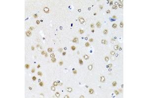 Immunohistochemistry of paraffin-embedded rat brain using RAB3IP antibody at dilution of 1:100 (x40 lens). (RAB3IP antibody)