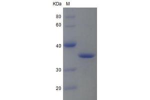 Western Blotting (WB) image for Annexin A5 (ANXA5) protein (His tag) (ABIN7319408) (Annexin V Protein (His tag))