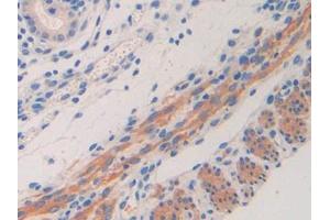 Used in DAB staining on fromalin fixed paraffin- embedded kidney tissue (IL11RA antibody  (AA 59-217))