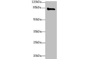 Western blot All lanes: KEL antibody at 3 μg/mL + HepG2 whole cell lysate Secondary Goat polyclonal to rabbit IgG at 1/10000 dilution Predicted band size: 83 kDa Observed band size: 83 kDa (KEL antibody  (AA 201-500))