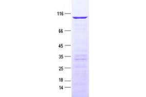 Validation with Western Blot (LCA5 Protein (His tag))