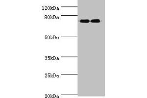 Western blot All lanes: ANAPC5 antibody at 2 μg/mL Lane 1: 293T whole cell lysate Lane 2: NIH/3T3 whole cell lysate Secondary Goat polyclonal to rabbit IgG at 1/10000 dilution Predicted band size: 86, 26, 73 kDa Observed band size: 86 kDa (ANAPC5 antibody  (AA 1-250))