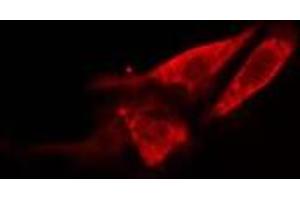 ABIN6278563 staining 293 cells by IF/ICC. (HSD17B11 antibody  (Internal Region))