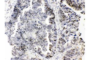 Immunohistochemistry (IHC) image for anti-E2F Transcription Factor 4, P107/p130-Binding (E2F4) (AA 106-144), (N-Term) antibody (ABIN4886566)