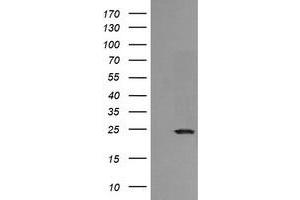 Image no. 2 for anti-RAB21, Member RAS Oncogene Family (RAB21) antibody (ABIN1500544) (RAB21 antibody)