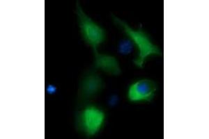 Image no. 3 for anti-butyrobetaine (Gamma), 2-Oxoglutarate Dioxygenase (Gamma-butyrobetaine Hydroxylase) 1 (BBOX1) antibody (ABIN1496815) (BBOX1 antibody)