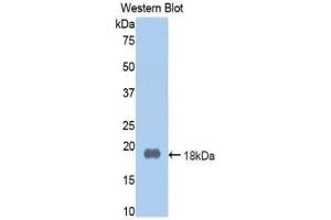 Western blot analysis of the recombinant protein. (Prothrombin antibody  (AA 201-324))