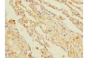 Immunohistochemistry of paraffin-embedded human lung tissue using ABIN7145856 at dilution of 1:100 (KCTD6 antibody  (AA 1-237))