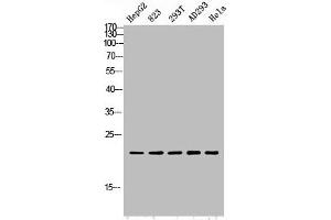 Western blot analysis of HepG2 823-AV 293T AD293 Hela lysis using PGLYRP1 antibody. (PGLYRP1 antibody  (Internal Region))