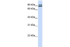 WB Suggested Anti-PCSK6 Antibody Titration: 0. (PCSK6 antibody  (N-Term))