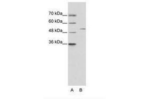 Image no. 1 for anti-Zinc Finger Protein 555 (ZNF555) (AA 25-74) antibody (ABIN6736216) (ZNF555 antibody  (AA 25-74))