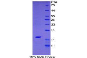 SDS-PAGE (SDS) image for SH2 Domain Containing 1A (SH2D1A) (AA 18-115) protein (His tag) (ABIN2126740)