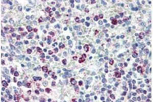 Human Spleen (formalin-fixed, paraffin-embedded) stained with HSPD1 antibody ABIN462102 at 10 ug/ml followed by biotinylated anti-mouse IgG secondary antibody ABIN481714, alkaline phosphatase-streptavidin and chromogen. (HSPD1 antibody)
