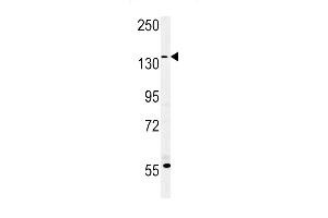 MUC1- Antibody (ABIN654056 and ABIN2843955) western blot analysis in MDA-M cell line lysates (35 μg/lane). (MUC1 antibody  (AA 1202-1231))