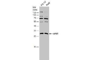 WB Image Various whole cell extracts (30 μg) were separated by 12% SDS-PAGE, and the membrane was blotted with HPRT antibody , diluted at 1:1000. (HPRT1 antibody)