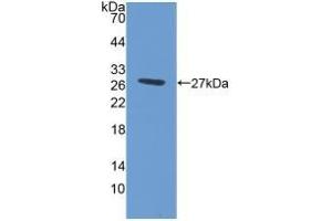 Detection of Recombinant ABCG1, Human using Polyclonal Antibody to ATP Binding Cassette Transporter G1 (ABCG1) (ABCG1 antibody  (AA 79-312))