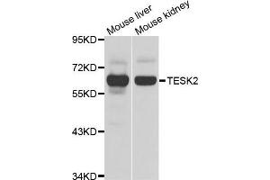 Western blot analysis of extracts of various cell lines, using TESK2 antibody (ABIN5975294) at 1/1000 dilution. (TESK2 antibody)