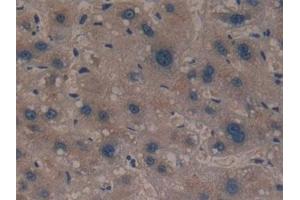 Detection of GCLM in Human Liver Tissue using Polyclonal Antibody to Glutamate Cysteine Ligase, Modifier Subunit (GCLM)