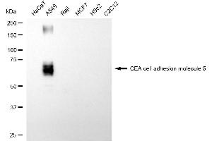 Western blotting analysis using CEA cell adhesion molecule 5 antibody (ABIN7797875).