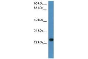 Image no. 1 for anti-Calcyphosine-Like (CAPSL) (C-Term) antibody (ABIN6746360)