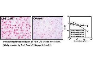 Immunohistochemical detection of TG in LPS treated mouse liver. (Thymidine Glycol antibody)
