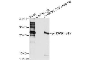 Immunoprecipitation analysis of 200 μg extracts of HeLa cells treated by EGF using 2. (HSP27 antibody  (pSer15))