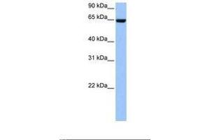 Image no. 1 for anti-Collagen, Type IV, alpha 3 (Goodpasture Antigen) Binding Protein (COL4A3BP) (AA 22-71) antibody (ABIN6738829) (COL4A3BP antibody  (AA 22-71))