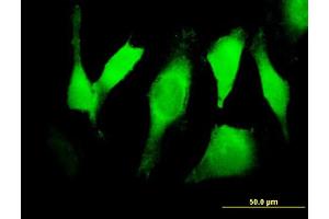 Immunofluorescence of purified MaxPab antibody to EGFR on HeLa cell.