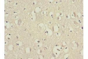 Immunohistochemistry of paraffin-embedded human brain tissue using ABIN7152155 at dilution of 1:100 (EIF3F antibody  (AA 88-357))