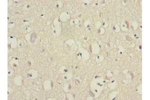 Immunohistochemistry of paraffin-embedded human brain tissue using ABIN7152155 at dilution of 1:100 (EIF3F antibody  (AA 88-357))