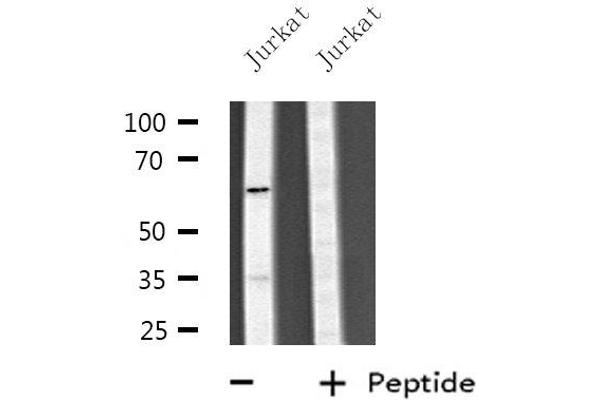 CYP4V2 antibody  (Internal Region)