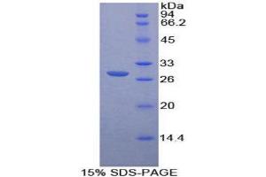 SDS-PAGE (SDS) image for Protein Tyrosine Phosphatase, Receptor Type, M (PTPRM) (AA 1197-1403) protein (His tag) (ABIN2126554)