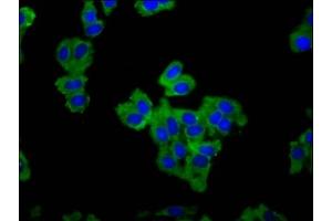 Immunofluorescence staining of HepG2 cells with ABIN7152382 at 1:66, counter-stained with DAPI. (F-Actin-Uncapping Protein LRRC16A (CARMIL1) (AA 1184-1295) antibody)