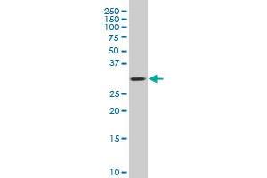 COPE polyclonal antibody (A01), Lot # 060116JC01 Western Blot analysis of COPE expression in HL-60 . (COPE antibody  (AA 211-308))