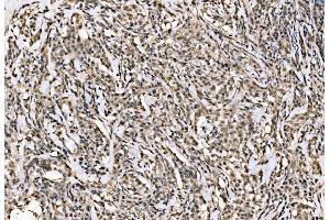 IHC analysis of WAPL/FOE using anti-WAPL/FOE antibody (ABIN7602663).