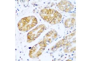 Immunohistochemistry of paraffin-embedded human stomach using NCAM1 antibody (ABIN5975670) at dilution of 1/100 (40x lens). (CD56 antibody)
