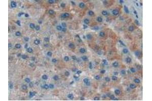 Detection of IkBd in Human Liver Tissue using Polyclonal Antibody to Inhibitory Subunit Of NF Kappa B Delta (IkBd) (IkBd antibody  (AA 46-285))
