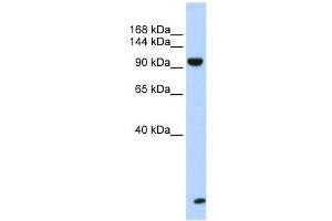 TNRC6B antibody used at 1 ug/ml to detect target protein. (TNRC6B antibody  (N-Term))