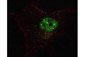 Fluorescent confocal image of SY5Y cells stained with PDX1 antibody. (PDX1 antibody  (AA 1-30))