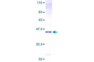 NFATC2IP Protein (AA 1-138) (GST tag)